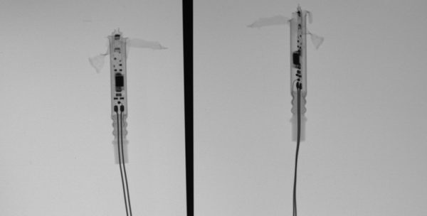 XRay Unit2